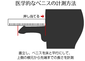 医学的なペニスの計測方法